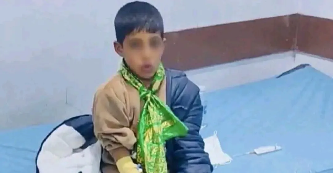 إصابة طفل بداء الكلب بحالة حرجة بعد تعرضه لعضة كلب في بابل